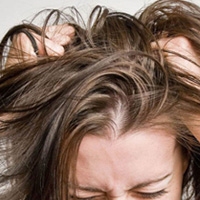 تصویر برای دسته  ضد التهاب و ضد خارش کف سر